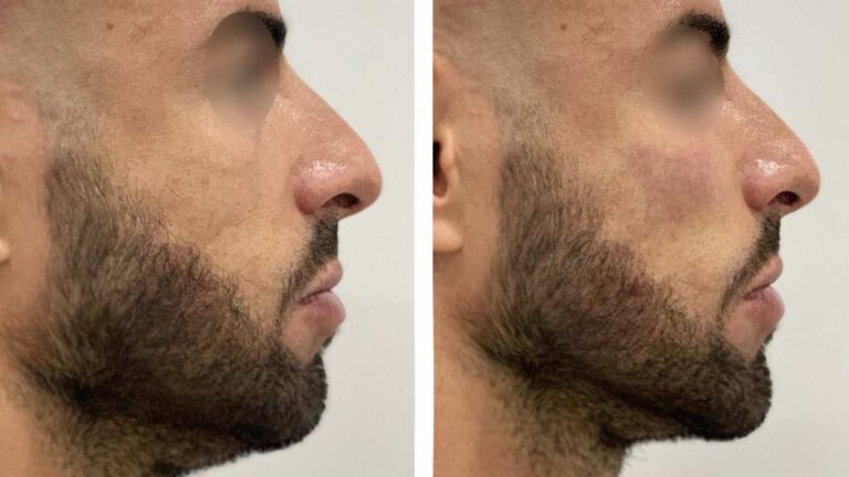 Mitos sobre los tratamientos faciales estéticos para hombres